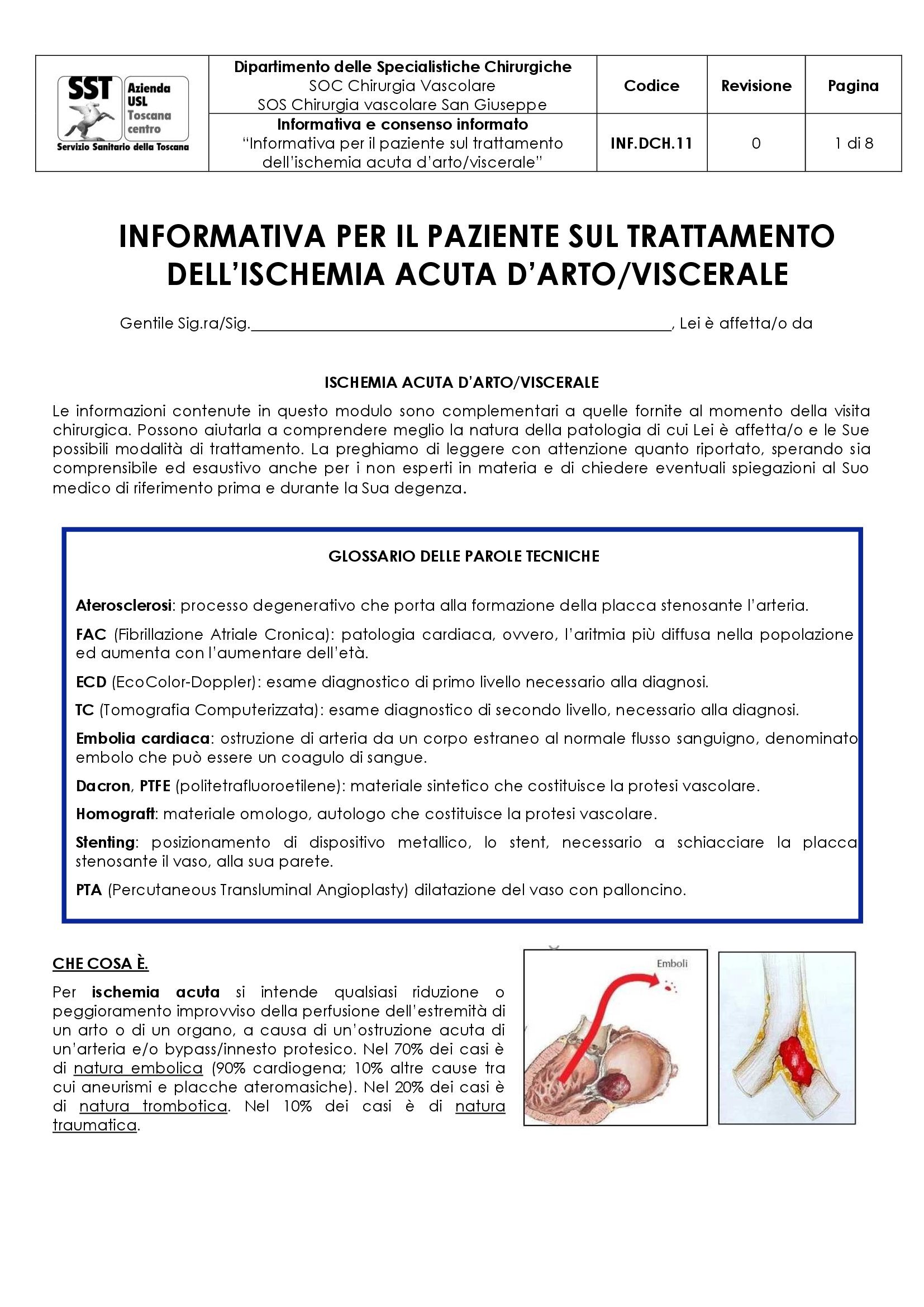 INF.DCH.11 “Informativa per il paziente sul trattamento dell’ischemia acuta d’arto/viscerale”